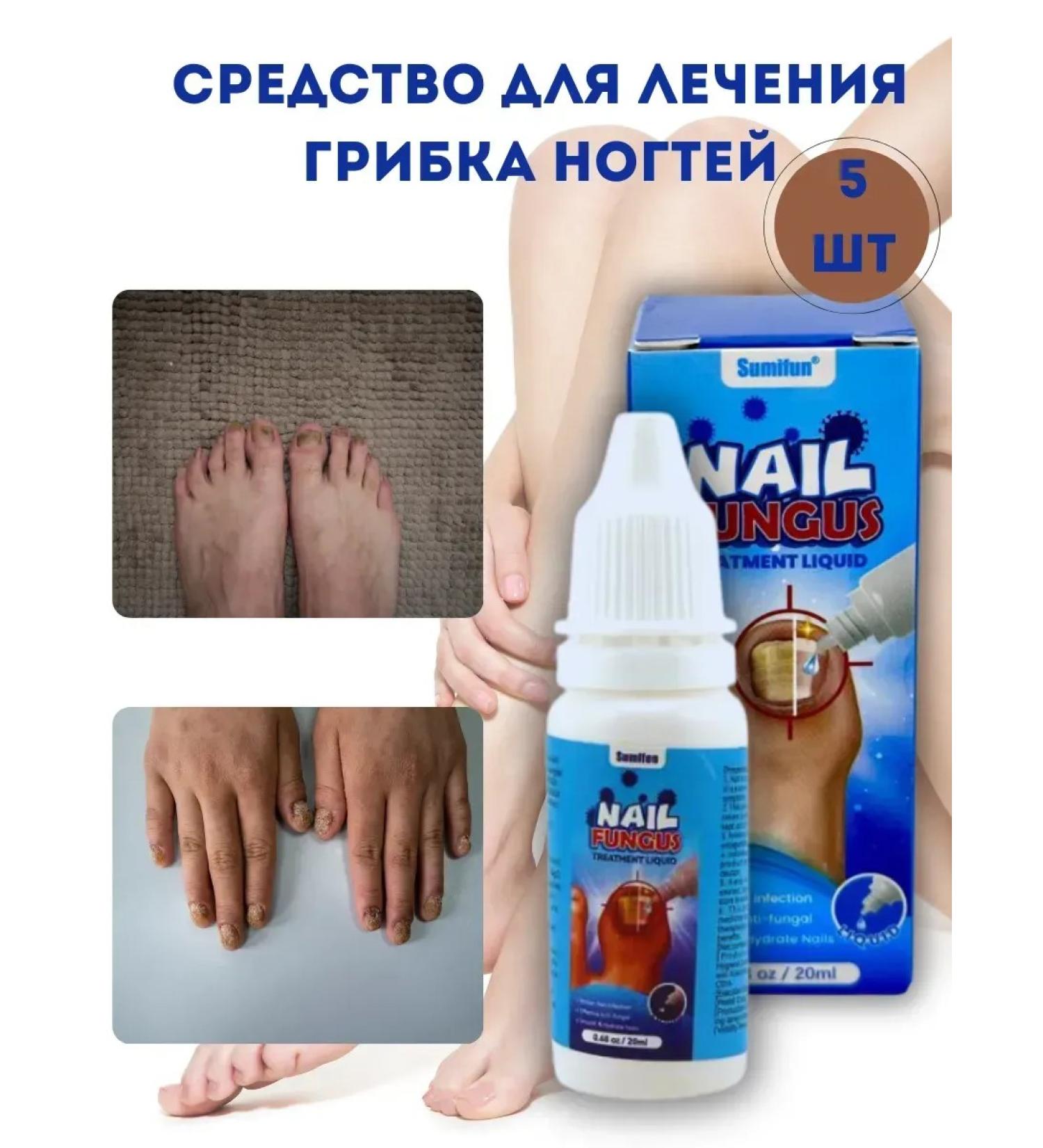 Kalis Feetor for the treatment of nail fungus - Buy Online on GoSupps.com