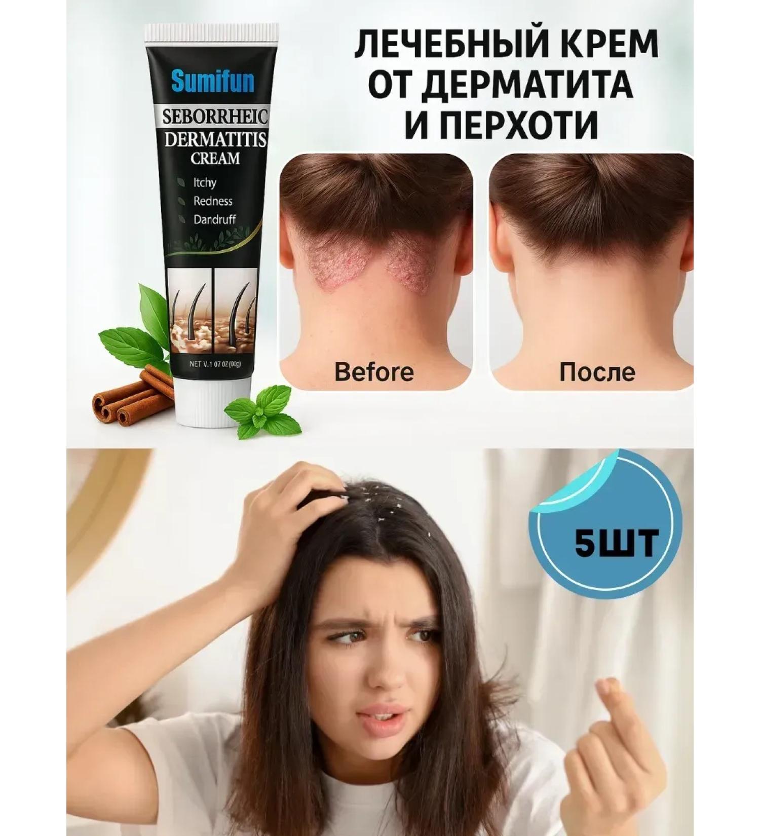 GChe Cream-cream for hair against dandruff - Buy Online on GoSupps.com