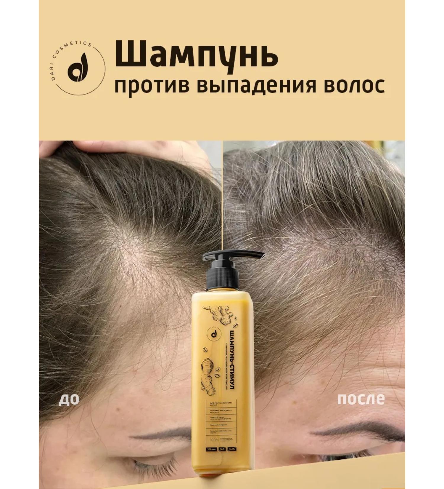 Dari cosmetics Hair loss shampoo-stimula 250ml - Buy Online on GoSupps.com