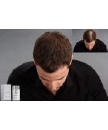 K -Hair Hairlinia Optimizer | Hair Compression Solution for Light & Thin Hair | Boost Volume & Coverage - Buy Online on GoSupps.com