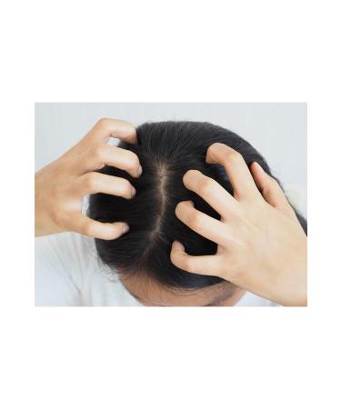 Mycolor Style & More Anti-Dandruff and Anti-Itching Cortisone-Free Care Shampoo 500 ml - Buy Online on GoSupps.com