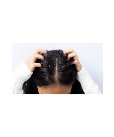 Mycolor Style & More Anti-Dandruff and Anti-Itching Cortisone-Free Care Shampoo 500 ml - Buy Online on GoSupps.com