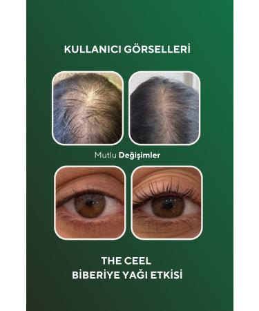 The Ceel Rosemary Oil Complex Fast Hair Growth Biotin Hair Care for Hair Loss and Damaged Hair - Buy Online on GoSupps.com