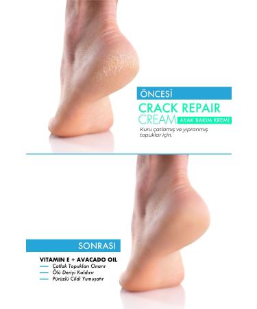 Picco De Luce MRS.UMRANTOO Crack Repair Cream Foot Care Cream 100 ml - Buy Online on GoSupps.com