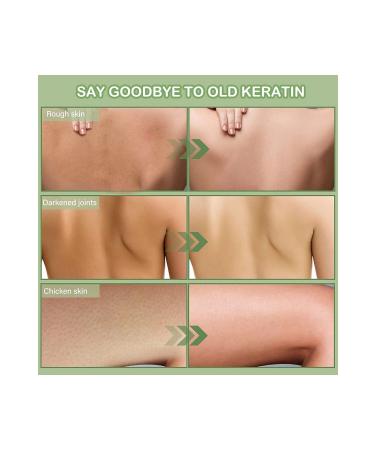 ROWENAROSE Peanut Peeling 200ml Post-Epilation Body Peeling Ingrown & Strawberry Leg Repair - Buy Online on GoSupps.com