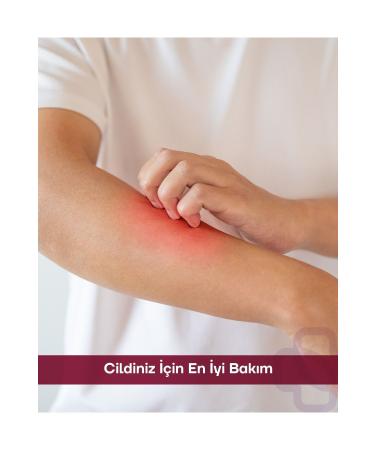 SantePlus Sos Recuops Repair Care Cream 125 ml (Eczema Psoriasis Itching) - Buy Online on GoSupps.com