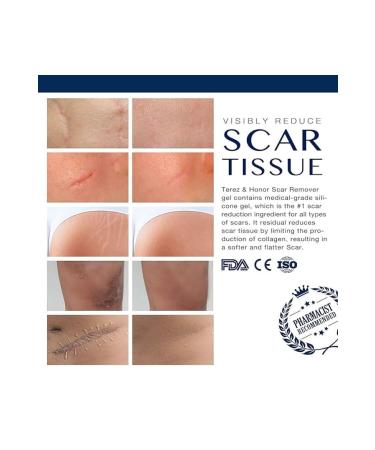 T&H Advanced Scar Gel. Scar Cream Anti-scar Scar Remover Medical Silicone & Collagen - Buy Online on GoSupps.com