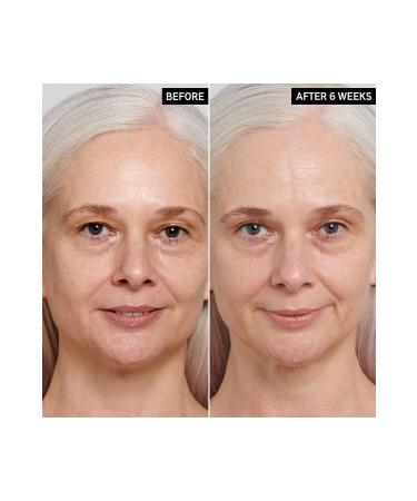 THE INKEY LIST Retinol - Serum 30ml - Buy Online on GoSupps.com