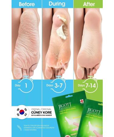 Jigott Sock Type Peeling Foot Mask - Miracle Foot Peeling Pack