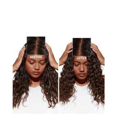 Kerastase Symbiose Routine Bain Puret Anti-Pelliculaire Purifying Shampoo for Oily Dandruff-Prone Hair 250mlCYT5 - Buy Online on GoSupps.com