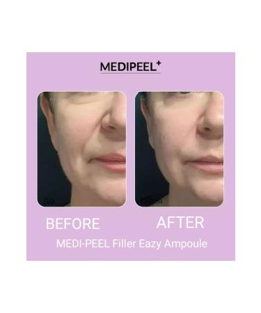 Medipeel Filler Eazy Ampoule 30 ml - Buy Online on GoSupps.com