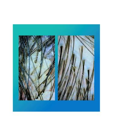 K18 PEPTIDE PREP Detox Shampoo - Shampoo 250 ml - Buy Online on GoSupps.com