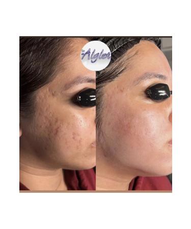 DR.ALGLER Algae Peeling Professional 5 Uses - Buy Online on GoSupps.com