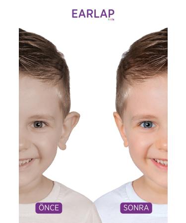 Beauty Tapes Earlap Kids Prominent Ear Headband - Buy Online on GoSupps.com