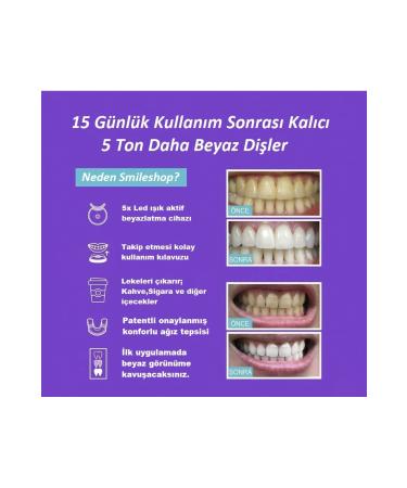 smileshop Teeth Whitening Kit - Buy Online on GoSupps.com