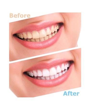 smileshop Teeth Whitening Kit - Buy Online on GoSupps.com