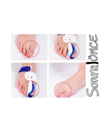 Lisinya Thumb Bone Corrective Night Splint (Pair)