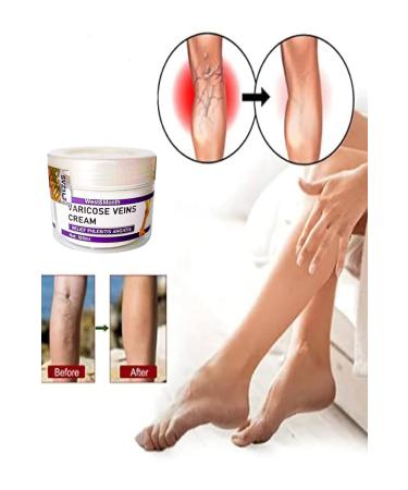 Varicose Veins Cream West&Month Anti-Cellulite Leg Care Cream 100 ml