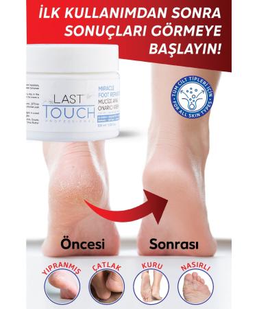 LAST TOUCH Crack Repair Miracle Foot Care Cream 100 ml (Pack of 2) - Buy Online on GoSupps.com