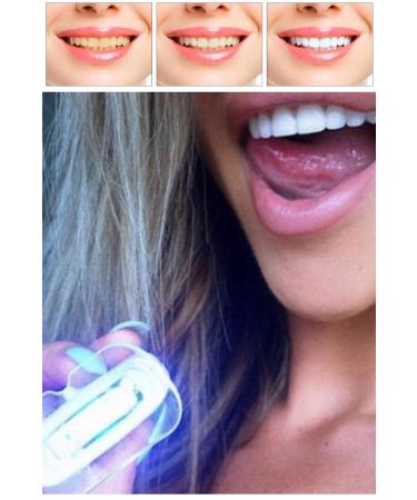 Quality Teeth Whitening Kit & Polishing Gel UV Light Dental Care Vitamin Bar Amazing Change - Buy Online on GoSupps.com