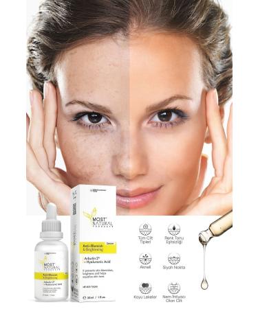 Most Natural Products Anti-Stain Skin Tone Equalizer and Brightener Arbutin Serum 30ml - Buy Online on GoSupps.com