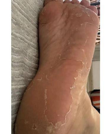 Dr Family Foot Peeling Mask - Peelable Exfoliating Foot Care Removes Odor and Calluses - Buy Online on GoSupps.com