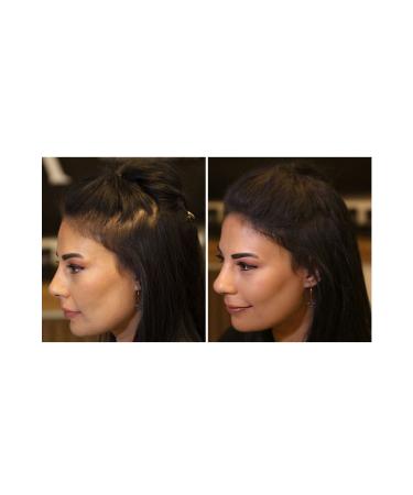 FIXPLANT Hair Volumizer 3 Bottles Topik 84 Gr. | Hair Powder for Thin Hair | Hair Fiber - Buy Online on GoSupps.com