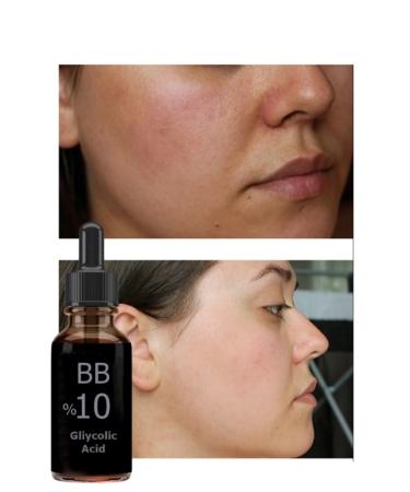 BB 'Luk Glycolic Acid & Light Peeling & Blemishes & Brightening & Pores - Buy Online on GoSupps.com
