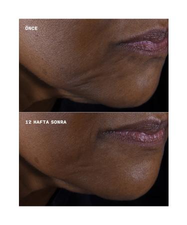 Clinique Smart Clinical Repair Lifting Effective Face and Neck Moisturizing Cream 50 ml - Buy Online on GoSupps.com