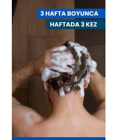 Ducray Kelual DS Anti-Scaling Flaking and Intensive Dandruff Care Shampoo 100ml - Buy Online on GoSupps.com
