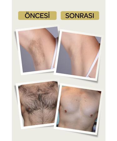 Elioure Ant Egg Oil Hair Reducing Effective Hair Removal Cream (UNISEX) - Buy Online on GoSupps.com