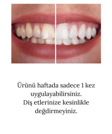 GELLO Teeth Whitening Gel - Buy Online on GoSupps.com