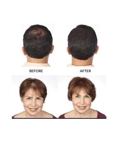 HairMax For Density Hairmax Hair Fibers Topik