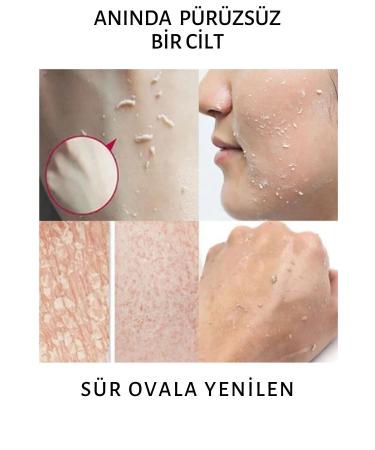 IKT Professional Blemish Cream Gel Dead Skin Peeling Cream 125 ml - Buy Online on GoSupps.com