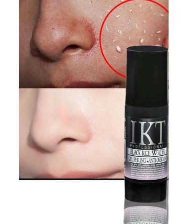 IKT Professional Blemish Cream Gel Dead Skin Peeling Cream 125 ml - Buy Online on GoSupps.com