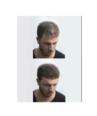 Jaja 100 gr Black Topical Hair Powder Hair Fiber - Buy Online on GoSupps.com