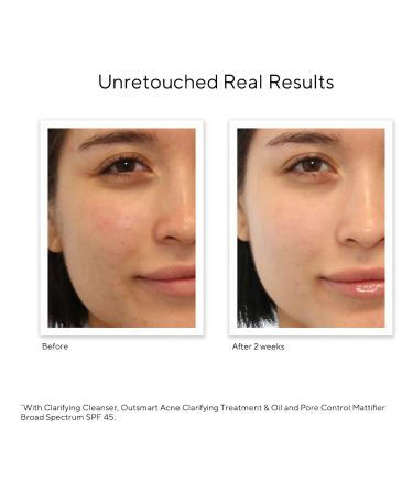 Murad Acne Control Clarifying Cleanser with Salicylic Acid 6.75 oz - Discover Premium Quality Shop now! - Buy Online on GoSupps.com