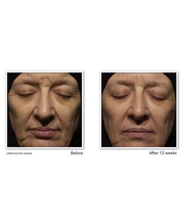 Discover RoC Retinol Correxion Anti-Aging + Firming Night Face Moisturizer 1.0 oz - Elevate Your Style Instantly! - Buy Online on GoSupps.com