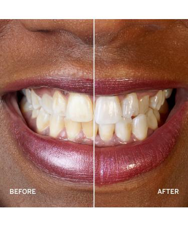 Supersmile Professional Whitening System - Transform Your Style with the Best Innovation Today! - Buy Online on GoSupps.com