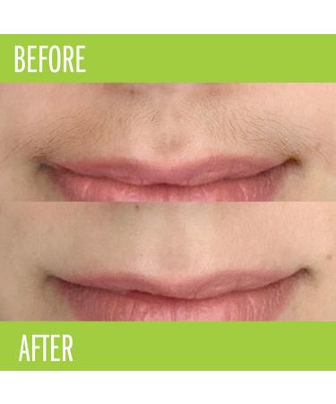 Discover Nads Natural Facial Wax Strips 24 ct - Elevate Your Style Instantly! - Buy Online on GoSupps.com