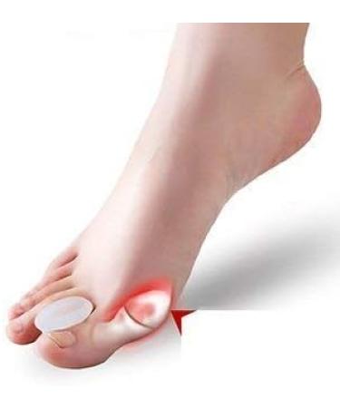 JHGCCL 2PCS Soft Gel Toe Corrector Pads for Hallux Valgus - Toe Straighteners and Protector for Bent Toes - Buy Online on GoSupps.com