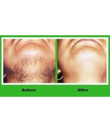 JEVR Healthier Life with Beauty Ponnatharam Hair Removal Powder (50 g) - Buy Online on GoSupps.com