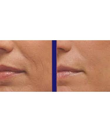 Magic Collagen Booster Serum - Time Reversing Anti-Aging with Argireline Matrixyl 3000 & Copper Peptides - 1oz - Buy Online on GoSupps.com