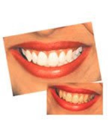 MaxxFoam Daily Teeth Whitening Maintenance | 8% Hydrogen Peroxide - Buy Online on GoSupps.com