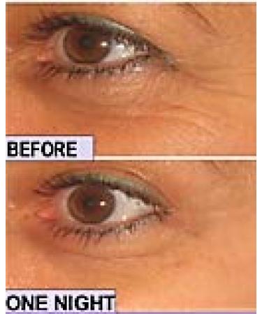 Smooth Sleepers Clear Cosmetic Strips - Flatten Wrinkles Overnight | 30 Day Supply - Buy Online on GoSupps.com