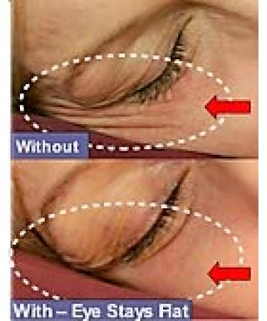 Smooth Sleepers Clear Cosmetic Strips - Flatten Wrinkles Overnight | 30 Day Supply - Buy Online on GoSupps.com