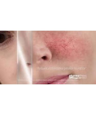 CoupeLIAC Special Skincare Gel - 20ml | Hydrating and Nourishing Formula - Buy Online on GoSupps.com