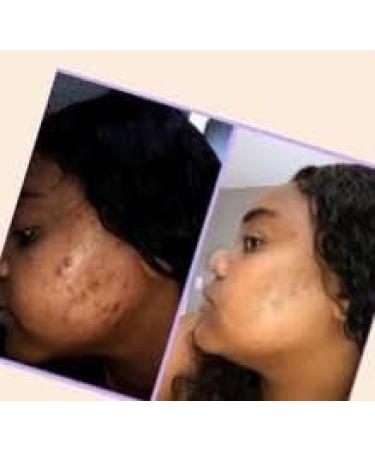 Phyto collagen whithening Lightening phyto collagen glutathione whitening VITAMIN C - Buy Online on GoSupps.com