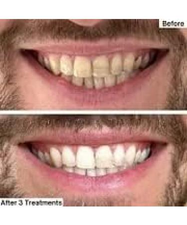 Teeth Whitening Powder for Tea, Coffee, Wine & Smoking Stain Removal - Mint Flavour (3PCS) - Buy Online on GoSupps.com