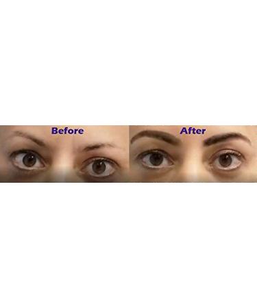 Finally Hair Dark Brown Dab-on Hair Fibers - Hair Loss Concealer & Gray Away Touch Up for Hairline, Eyebrows, and Beard - Instantly Covers Gray Hair - Buy Online on GoSupps.com